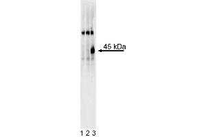Western blot analysis of Sox17 in definitive endoderm derived from human embryonic stem (ES) cells.