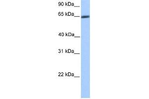 Transfected 293T; WB Suggested Anti-ZNF449 Antibody Titration: 0. (ZNF449 Antikörper  (N-Term))
