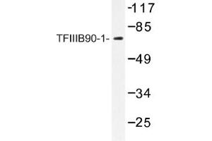 Image no. 1 for anti-BRF1, RNA polymerase III transcription initiation factor subunit (BRF1) antibody (ABIN317615) (BRF1 Antikörper)
