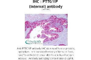 Image no. 1 for anti-Pituitary Tumor-Transforming 1 Interacting Protein (PTTG1IP) (Internal Region) antibody (ABIN1738624) (PTTG1IP Antikörper  (Internal Region))
