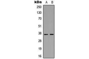 Western blot analysis of MMP10 expression in Jurkat (A), HepG2 (B) whole cell lysates. (MMP10 Antikörper  (C-Term))