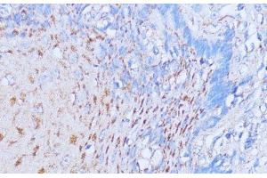 Immunohistochemistry of paraffin-embedded Human esophageal using NME6 Polyclonal Antibody at dilution of 1:100 (40x lens). (NME6 Antikörper)