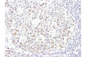 anti-Enhancer of Zeste Homolog 2 (EZH2) (AA 696-746) antibody
