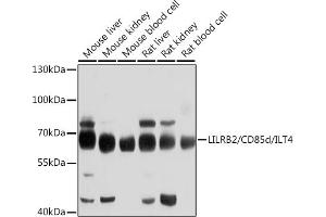 Western blot analysis of extracts of various cell lines, using LILRB2/CD85d/ILT4 antibody (ABIN6131861, ABIN6143217, ABIN6143219 and ABIN6214278) at 1:1000 dilution. (LILRB2 Antikörper)
