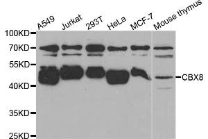 Western blot analysis of extracts of various cell lines, using CBX8 antibody (ABIN5973663) at 1/1000 dilution.