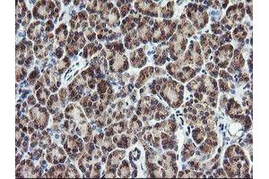 Image no. 7 for anti-Phosphoinositide-3-Kinase, Catalytic, gamma Polypeptide (PIK3CG) antibody (ABIN1500203)
