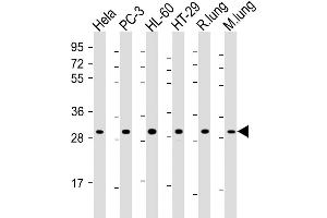 Western Blot at 1:2000 dilution Lane 1: Hela whole cell lysate Lane 2: PC-3 whole cell lysate Lane 3: HL-60 whole cell lysate Lane 4: HT-29 whole cell lysate Lane 5: rat lung lysate Lane 6: mouse lung lysate Lysates/proteins at 20 ug per lane.