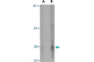 Western blot analysis of ENDOG expression in HepG2 cell lysate with ENDOG monoclonal antibody, clone 7F2G10  at (A) 5 and (B) 10 ug/mL . (Endonuclease G Antikörper  (AA 76-170))