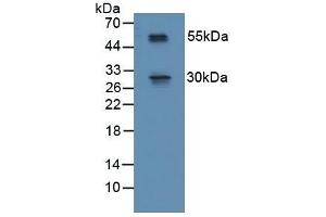 Detection of RSPO1 in Mouse Spinal Cord Tissue using Polyclonal Antibody to R-Spondin 1 (RSPO1) (RSPO1 Antikörper  (AA 21-135))