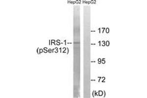 Western Blotting (WB) image for anti-Insulin Receptor Substrate 1 (IRS1) (pSer312) antibody (ABIN2888448) (IRS1 Antikörper  (pSer312))