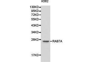 Western Blotting (WB) image for anti-RAB7A, Member RAS Oncogene Family (RAB7A) antibody (ABIN1874518) (RAB7A Antikörper)