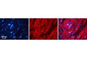 Rabbit Anti-DMAP1 Antibody   Formalin Fixed Paraffin Embedded Tissue: Human heart Tissue Observed Staining: Cytoplasmic Primary Antibody Concentration: 1:100 Other Working Concentrations: N/A Secondary Antibody: Donkey anti-Rabbit-Cy3 Secondary Antibody Concentration: 1:200 Magnification: 20X Exposure Time: 0.