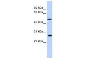 Image no. 1 for anti-Zinc Finger Protein 556 (ZNF556) (AA 36-85) antibody (ABIN6740460) (ZNF556 Antikörper  (AA 36-85))