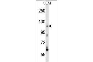 Western blot analysis in CEM cell line lysates (35ug/lane). (ARHGEF1 Antikörper  (N-Term))