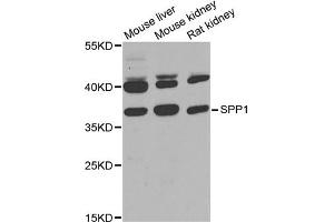 Western blot analysis of extracts of various cell lines, using SPP1 antibody (ABIN1874927) at 1:1000 dilution.