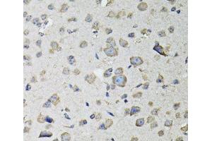 Immunohistochemistry of paraffin-embedded Mouse brain using RASSF1 Polyclonal Antibody at dilution of 1:100 (40x lens). (RASSF1 Antikörper)