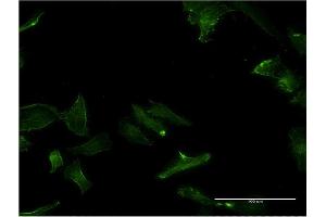 Immunofluorescence of monoclonal antibody to GPC5 on HeLa cell.
