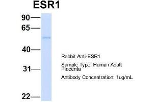 Host: Rabbit  Target Name: ESR1  Sample Tissue: Human Adult Placenta  Antibody Dilution: 1. (Estrogen Receptor alpha Antikörper  (C-Term))