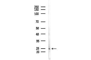 Western blot analysis of lysates from COLO205 cells(heat-shock,45 min treatment), using ARL5B Antibody at 1/1000 dilution.
