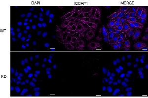 Immunocytochemical staining of HepG2 cells using IQGAP1 antibody (ABIN7799120), 1:1,000), Top panel: wild-type (WT), Bottom panal: IQGAP1 shRNA knockdown (KD).