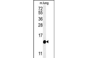 Western blot analysis of IFT20 Antibody (Center)  in mouse lung tissue lysates (35 μg/lane). (IFT20 Antikörper  (Center))