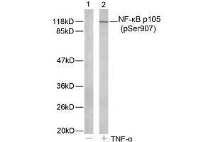 Western Blotting (WB) image for anti-Nuclear Factor of kappa Light Polypeptide Gene Enhancer in B-Cells 1 (NFKB1) (pSer907) antibody (ABIN7138727)