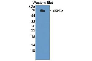 Western blot analysis of the recombinant protein. (SLC26A8 Antikörper  (AA 664-970))