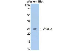 Western Blotting (WB) image for anti-Matrix Metallopeptidase 13 (Collagenase 3) (MMP13) (AA 103-290) antibody (ABIN1172282)
