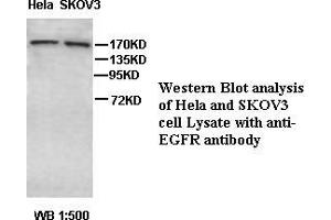 Image no. 1 for anti-Epidermal Growth Factor Receptor (EGFR) antibody (ABIN791216) (EGFR Antikörper)