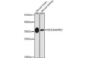 Western blot analysis of extracts of various cell lines, using EB3/EB3/M antibody (ABIN6130540, ABIN6143547, ABIN6143548 and ABIN6225046) at 1:3000 dilution. (MAPRE3 Antikörper  (AA 1-281))