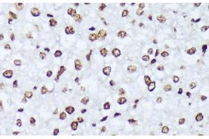 Immunohistochemistry of paraffin-embedded Mouse liver using Phospho-ABL1(Y245) Polyclonal Antibody at dilution of 1:100 (40x lens). (ABL1 Antikörper  (pTyr245))