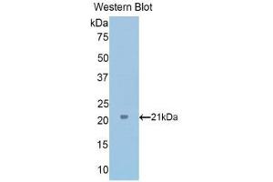 Western Blotting (WB) image for anti-Tumor Protein, Translationally-Controlled 1 (TPT1) (AA 1-172) antibody (ABIN1176579) (TPT1 Antikörper  (AA 1-172))