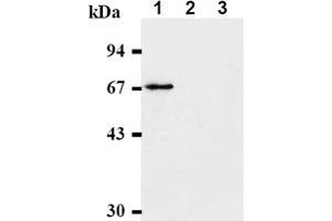 Western Blotting (WB) image for anti-Checkpoint Kinase 2 (CHEK2) antibody (ABIN487312) (CHEK2 Antikörper)
