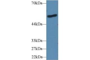 Detection of LBP in Human A431 cell lysate using Polyclonal Antibody to Lipopolysaccharide Binding Protein (LBP) (LBP Antikörper  (AA 25-481))
