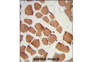 Formalin-fixed and paraffin-embedded human skeletal muscle reacted with PHYH2 Antibody (C-term), which was peroxidase-conjugated to the secondary antibody, followed by DAB staining. (HACL1 Antikörper  (C-Term))
