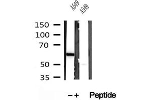 Western blot analysis of extracts of A549 cells, using PFKFB3-Specific antibody. (PFKFB3 Antikörper  (C-Term))