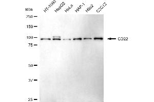 Western blotting analysis using CD22 antibody (ABIN7797959).