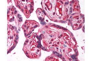 Anti-E2F2 antibody IHC of human placenta.