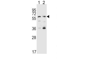 Western Blotting (WB) image for anti-Solute Carrier Family 22 Member 4 (SLC22A4) antibody (ABIN3002503) (SLC22A4 Antikörper)