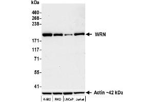 anti-Werner syndrome RecQ like helicase (WRN) (C-Term) antibody