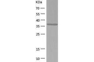 Western Blotting (WB) image for Guanosine Monophosphate Reductase 2 (GMPR2) (AA 1-348) protein (His tag) (ABIN7123244) (GMPR2 Protein (AA 1-348) (His tag))