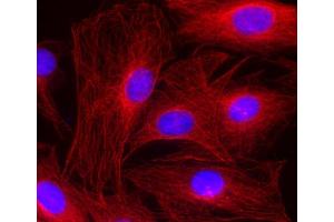 Immunocytochemistry (ICC) image for anti-alpha Tubulin (TUBA1) (AA 443-449) antibody (ABIN1742552) (alpha Tubulin Antikörper  (AA 443-449))