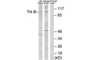 Western blot analysis of extracts from rat brain/mouse brain cells, treated with PBS 60', using Trk B (Ab-515) Antibody. (TRKB Antikörper  (AA 481-530))
