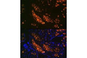 Immunofluorescence analysis of human placenta using HBG1 Rabbit mAb (ABIN1679149, ABIN1679148, ABIN7101336 and ABIN7101337) at dilution of 1:100 (40x lens). (HBG1/2 Antikörper)