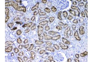 IHC analysis of RBP4 using anti-RBP4 antibody . (RBP4 Antikörper  (AA 19-201))