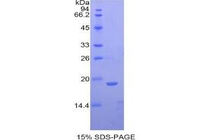 SDS-PAGE (SDS) image for Fibrillin 1 (FBN1) ELISA Kit (ABIN6574171)