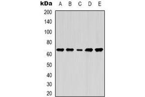 Western blot analysis of Lamin B1 expression in MCF7 (A), A549 (B), SKOV3 (C), mouse brain (D), mouse liver (E) whole cell lysates. (Lamin B1 Antikörper)