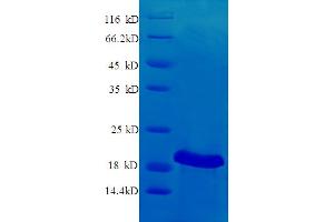 SDS-PAGE (SDS) image for CD40 Ligand (CD40LG) (AA 113-261) protein (His tag) (ABIN5713334)