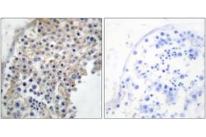 Immunohistochemistry analysis of paraffin-embedded human testis tissue, using Adrenergic Receptor alpha-2A Antibody. (ADRA2A Antikörper  (AA 331-380))