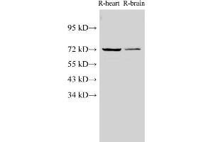 Western Blot analysis of Rat heart and Rat brain using Lamin B1 Polyclonal Antibody at dilution of 1:1000 (Lamin B1 Antikörper)